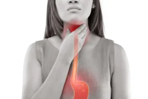 The image depicts a woman experiencing discomfort or pain in her throat, with a visual representation of the esophagus highlighted in red, which suggests irritation or inflammation. This is likely a depiction of acid reflux or gastroesophageal reflux disease (GERD), where stomach acid flows back into the esophagus, causing a burning sensation in the chest or throat, commonly referred to as heartburn. The red area extending from her throat down into her esophagus symbolizes where the irritation or pain is likely occurring. This type of image is often used to illustrate symptoms of digestive conditions such as acid reflux.